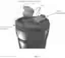 Fig. 07 - LEAK-PROOF CONTAINER LID WITH FOAM INSULATION