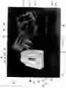 Fig. 07 - Apparatus and methods for safely collecting and disposing of sharps waste