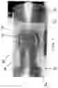 Fig. 08 - Apparatus and methods for safely collecting and disposing of sharps waste
