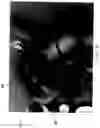 Fig. 11 - Apparatus and methods for safely collecting and disposing of sharps waste