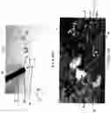 Fig. 13 - Apparatus and methods for safely collecting and disposing of sharps waste
