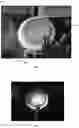 Fig. 03 - Method for detecting fluid injection in a patient