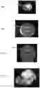 Fig. 04 - Method for detecting fluid injection in a patient