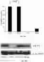 Fig. 13 - METHOD AND SYSTEM FOR IN VIVO DETECTION OF ADIPOSE TISSUE BROWNING