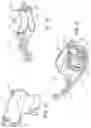 Fig. 17 - Articulating surgical instruments