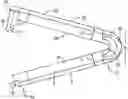 Fig. 01 - Clip for broad suture