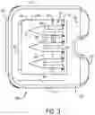 Fig. 04 - Clip for broad suture