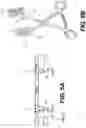 Fig. 09 - Devices and methods for wound closure