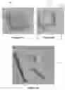 Fig. 06 - Anatomical side x-ray markers comprising non-metallic material