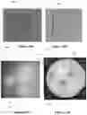 Fig. 09 - Anatomical side x-ray markers comprising non-metallic material