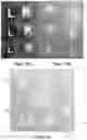 Fig. 11 - Anatomical side x-ray markers comprising non-metallic material