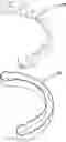 Fig. 01 - Method of self determining the degree of fit of an orthodontic aligner by a patient with the patient's teeth
