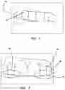 Fig. 02 - Method of self determining the degree of fit of an orthodontic aligner by a patient with the patient's teeth