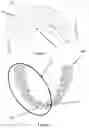 Fig. 06 - Digitizing and merging sectional impression trays to create a dental arch for dental device manufacturing