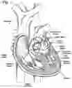 Fig. 02 - Collapsible-expandable heart valves