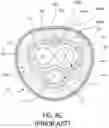 Fig. 29 - PENILE SLEEVE DEVICES AND PENILE STOCKING INSERT AND METHODS OF MAKING THE SAME