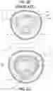 Fig. 32 - PENILE SLEEVE DEVICES AND PENILE STOCKING INSERT AND METHODS OF MAKING THE SAME