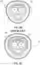 Fig. 35 - PENILE SLEEVE DEVICES AND PENILE STOCKING INSERT AND METHODS OF MAKING THE SAME