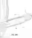 Fig. 36 - PENILE SLEEVE DEVICES AND PENILE STOCKING INSERT AND METHODS OF MAKING THE SAME