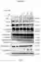 Fig. 44 - Tumor pH-shiftable coating and the nucleus-directed nanoparticles facilitate the targeted chemotherapy and gene therapy against multiple cancers and use thereof