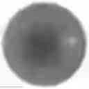 Fig. 01 - Novel Method of Treating Macular Degeneration Using Botulinum Toxin-Based Pharmaceuticals