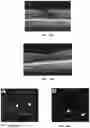Fig. 10 - Novel Method of Treating Macular Degeneration Using Botulinum Toxin-Based Pharmaceuticals
