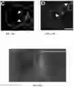 Fig. 11 - Novel Method of Treating Macular Degeneration Using Botulinum Toxin-Based Pharmaceuticals