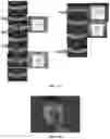 Fig. 13 - Novel Method of Treating Macular Degeneration Using Botulinum Toxin-Based Pharmaceuticals