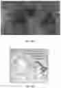 Fig. 19 - Novel Method of Treating Macular Degeneration Using Botulinum Toxin-Based Pharmaceuticals