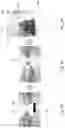 Fig. 04 - SYRINGE FILLING ADJUSTMENT DEVICES AND METHODS