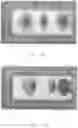 Fig. 04 - RADIATION THERAPY SYSTEM, CONTROL METHOD FOR CONTROLLING MEDICAL DEVICE, AND CONTROLLER FOR CONTROLLING MEDICAL DEVICE