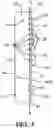Fig. 04 - Snowsport equipment positional stabilization