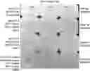 Fig. 01 - PROCESS FOR HEAT SETTING TWISTED, BULKED CONTINUOUS FILAMENT YARN