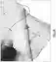 Fig. 04 - RIGID AND SEMI-RIGID COMPOSITES INCORPORATING WOVEN MULTI-LAYER FABRICS