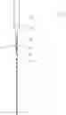 Fig. 01 - Wellbore friction measurement, method and apparatus