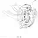 Fig. 03 - Dual stage compound bow