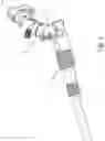Fig. 02 - Double lock connector