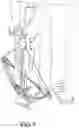 Fig. 04 - Crossbow cocking using two separate handheld pullers