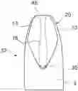 Fig. 01 - Intermediate for manufacturing projectiles of a deformable bullet, projectile, deformed projectile, tool for manufacturing the intermediate and method for manufacturing the intermediate