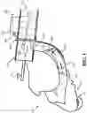 Fig. 03 - Baler with NIR sensor in plunger face