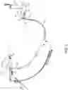 Fig. 06 - Adjustable stuffer chute