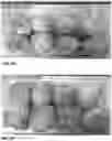 Fig. 35 - Lettuce variety ‘payday’