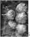 Fig. 46 - Lettuce variety ‘payday’
