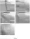 Fig. 04 - COMPOSITION AND METHOD FOR IMPROVING THE DEVELOPMENT OF PLANTS