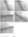 Fig. 06 - COMPOSITION AND METHOD FOR IMPROVING THE DEVELOPMENT OF PLANTS
