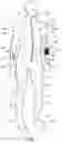 Fig. 06 - Combination vibrational and thermal jumper