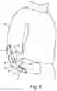 Fig. 03 - MODULAR PROTECTIVE SYSTEM FOR JOINTS, METHOD, AND KIT
