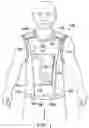 Fig. 02 - Medical apparatus