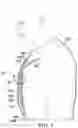 Fig. 03 - Medical apparatus