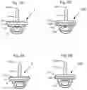 Fig. 07 - FASHION SCRUNCH CLIP APPARATUS AND METHOD